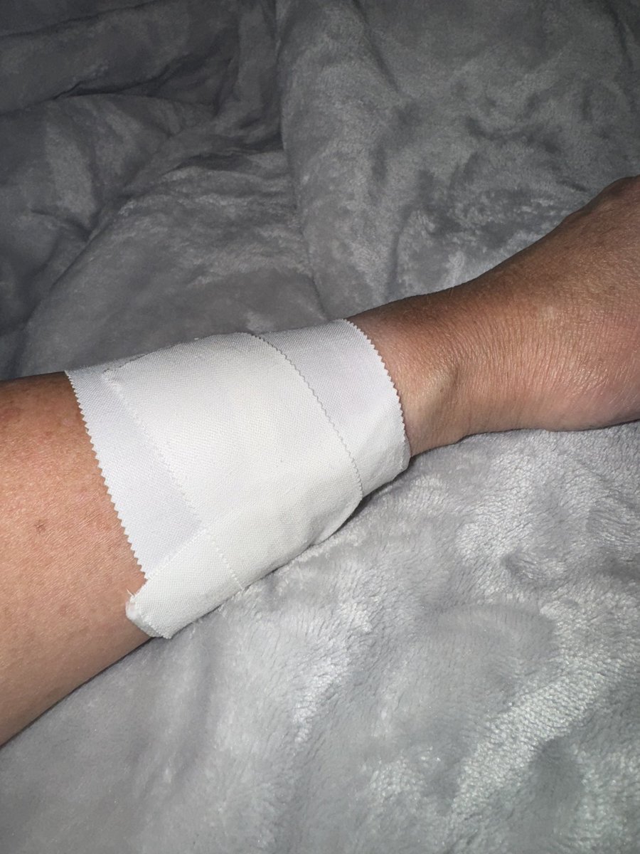 itsheatherleigh's tweet image. PSA: Don’t put your arms anywhere near an electric, boiling tea kettle.
I’m on day 4 of dealing with a very painful second degree burn on my wrist after grabbing a mug from my cabinet and getting too close to the nozzle of the kettle. I was multitasking and not paying…