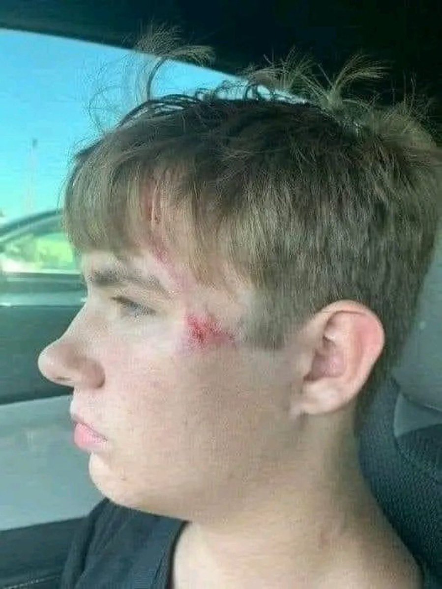 Thread 🧵 

1) "This is my friend's 17 year old nephew, Tanner. Yesterday he was enjoying a day at Scissortail Park with his mother and younger siblings when he noticed a person struggling in the pond. Tanner's mom said he did a quick double take then without a word he was