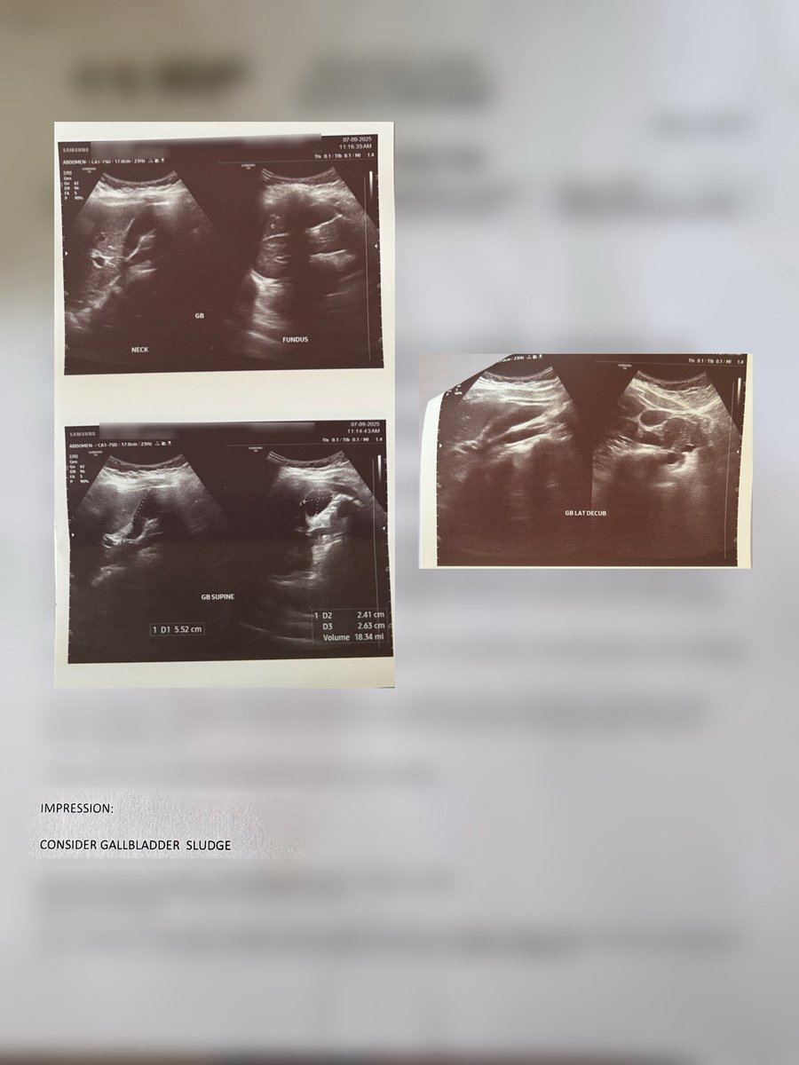 Gmonad again, <a href="/monad_xyz/">Monad</a> fam 💜

Quick update from me since a lot of you have been reaching out and checking in. First of all, thank you. I’ve read your messages and felt your warmth, and it truly means so much. 

I finally got my ultrasound results yesterday, and thankfully,