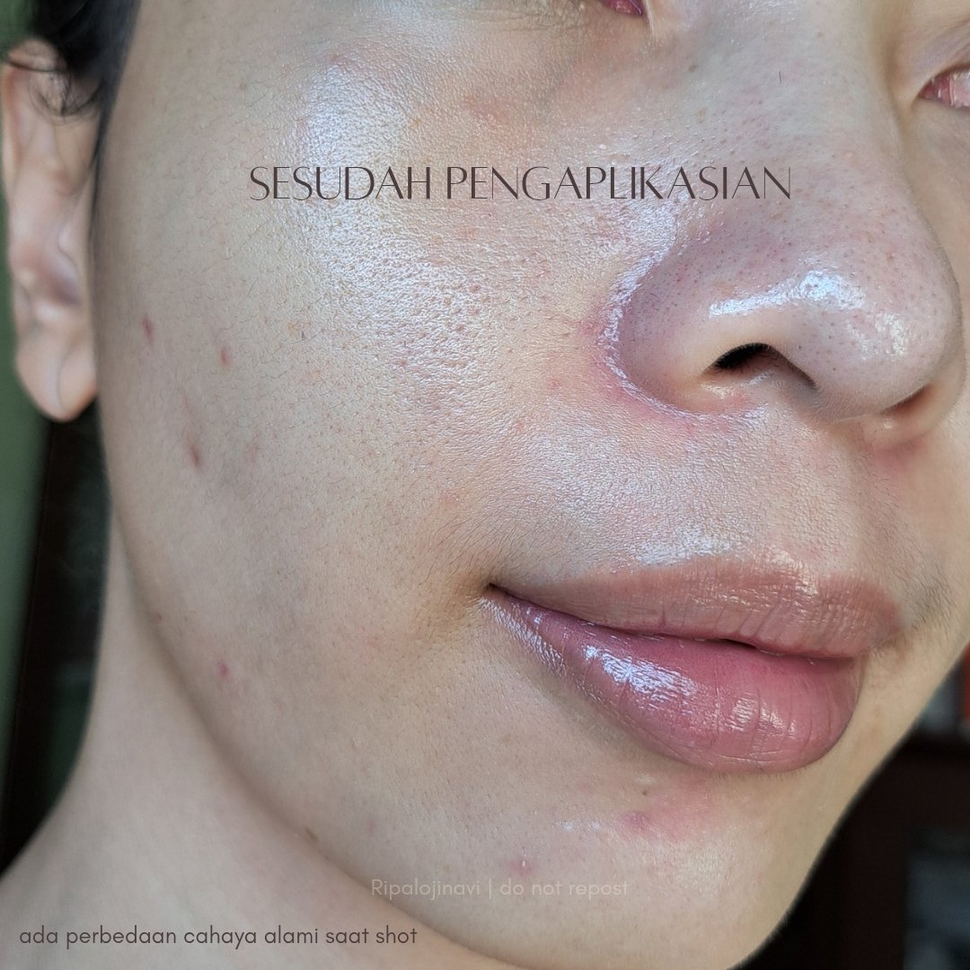 Ripalojinavi's tweet image. 😭 Baru dipake udah di-HM emak sendiri gegara &apos;cerahnya cepet ye, teh&apos;. Emang sik selain kulit jadi #glasskin, dipakenya enteng, lembap tapi velvety jadi gak hinyai, nyerahin dalem seminggu cukup keliatan. 

Kalau kamu ada darkspot karena #hyperpigmentation/ kusam cobain aja bes!