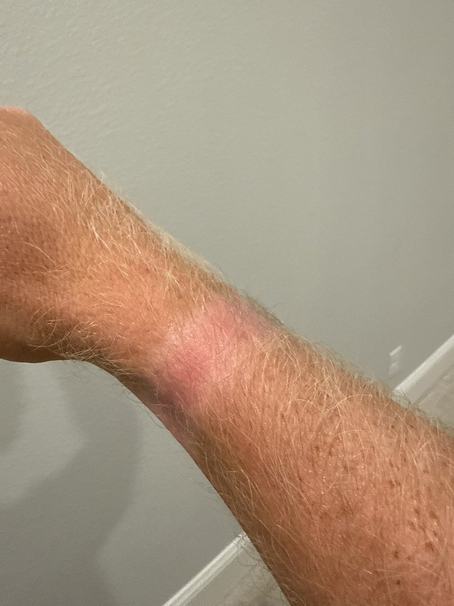 CalebJHull's tweet image. Tried to even out my whoop tan line and instead just added racing stripes
