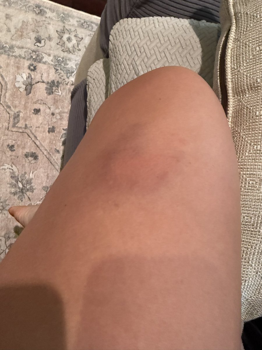 Paisley Campbell (@2025paisley) on Twitter photo I did a lot of blocking behind the plate <a href="/legacyshowcase1/">Atlanta Legacy Showcase</a> . We ended the weekend with a top 8 finish. Looking forward to Nationals in Indy.
<a href="/FPlatinum2025/">Fury Platinum National Davenport (2025)</a> <a href="/ChelseaEFarmer/">Chelsea Farmer</a> <a href="/UTM_DFarmer/">UTM_DFarmer</a> I did a lot of blocking behind the plate <a href="/legacyshowcase1/">Atlanta Legacy Showcase</a> . We ended the weekend with a top 8 finish. Looking forward to Nationals in Indy.
<a href="/FPlatinum2025/">Fury Platinum National Davenport (2025)</a> <a href="/ChelseaEFarmer/">Chelsea Farmer</a> <a href="/UTM_DFarmer/">UTM_DFarmer</a>