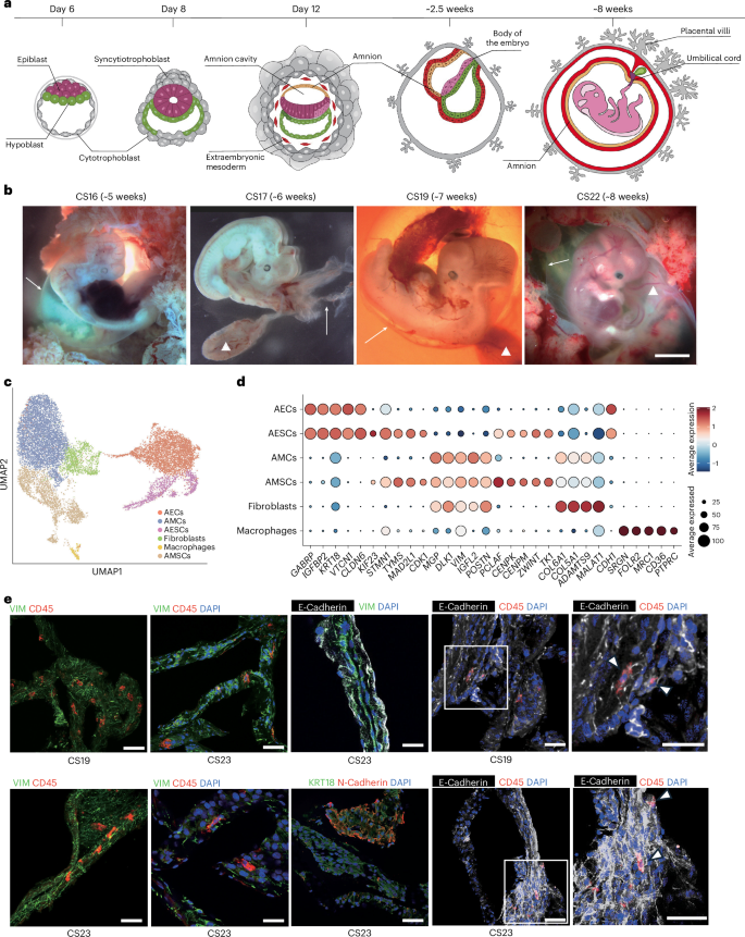 medntdj's tweet image. Atlas of amnion development during the first trimester of human pregnancy
@NatureCellBio
@ZernickaGoetz
nature.com/articles/s4155…
via @LabWaggoner