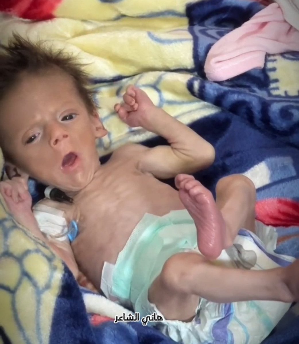 yemenstarvi's tweet image. Imagine if that was your child.