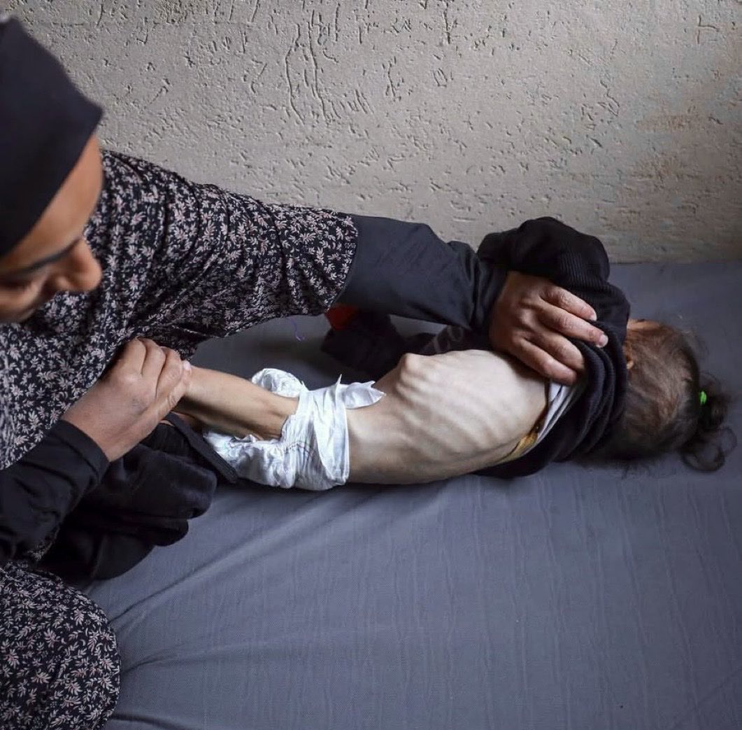 yemenstarvi's tweet image. Shame!