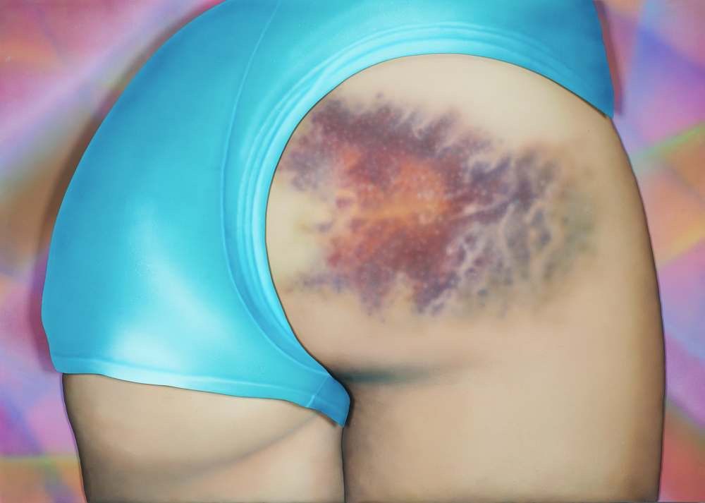 Roller Derby Kisses: Turning Girls' Roller-Derby Bum Bruises Into Art - Flashbak flashbak.com/roller-derby-k…