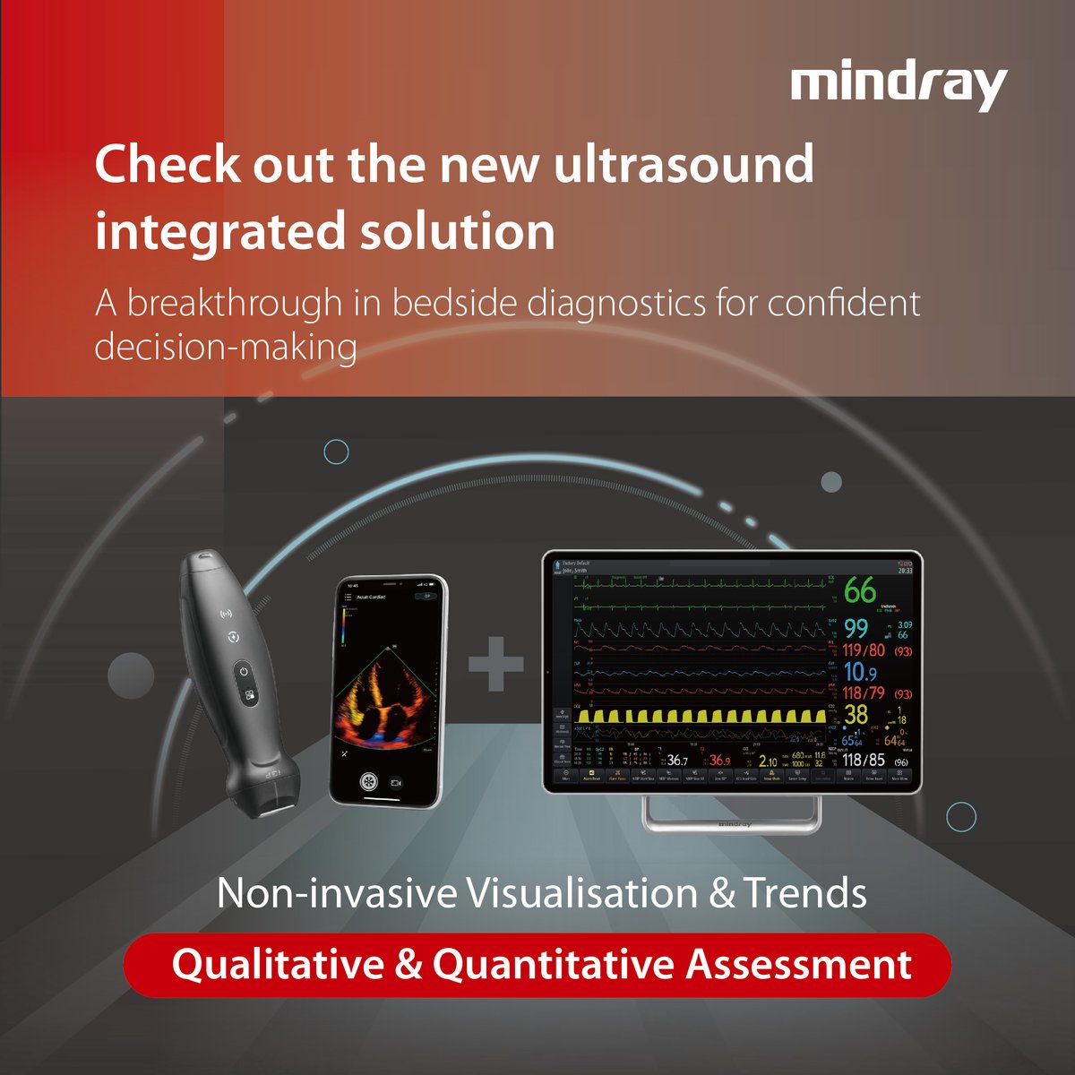 The new #BeneVisionV Series now integrates POCUS directly into bedside hemodynamic assessment. Clinicians can visualize, analyse, and document both real-time and historical ultrasound findings directly through the monitors. More at mindray.com/en/products/pa…
#SeeBeyondYourVision