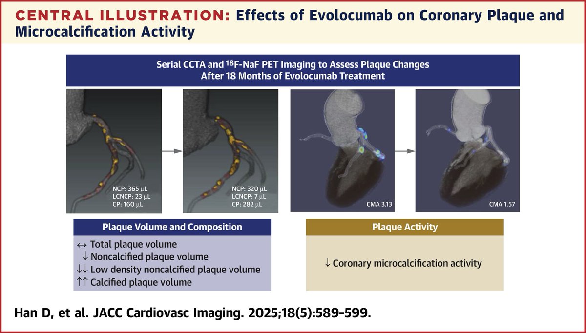 Kansas ACC (@kansasacc) on Twitter photo Plaque progression by #YesCCT & #cvPET w/ #PCSK9i?
In stable pts w/ extensive non-calcified plaque, 18 mos of evolocumab Tx lowered risk plaque & microcalcification.
🔗 ow.ly/HgFp50W5zw0
#JACCIMG #cvCAD <a href="/tamarappoo/">tamarappoo</a> Plaque progression by #YesCCT & #cvPET w/ #PCSK9i?
In stable pts w/ extensive non-calcified plaque, 18 mos of evolocumab Tx lowered risk plaque & microcalcification.
🔗 ow.ly/HgFp50W5zw0
#JACCIMG #cvCAD <a href="/tamarappoo/">tamarappoo</a>