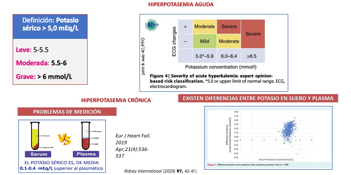💥🔥 ¿Sabías que el potasio varía según cómo se mide?
💉 Potasio sérico: puede ser más alto por liberación de K+ de plaquetas al coagular.
🔬Potasio en plasma: más preciso en sospecha de hiperpotasemia falsa.
🩸¡La muestra importa!🩸
👇👇👇