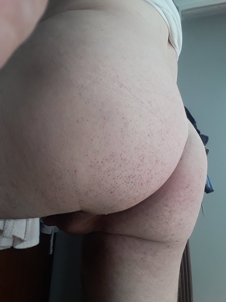 Can sıkıntısı 
Yalanyanda yok