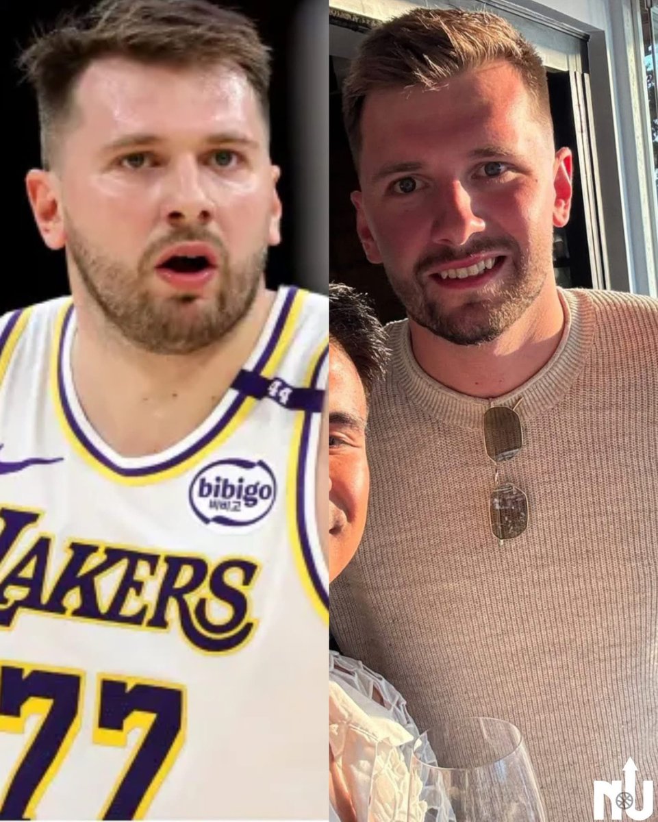 Just by looking at his face, you could tell how much weight he has lost 👏