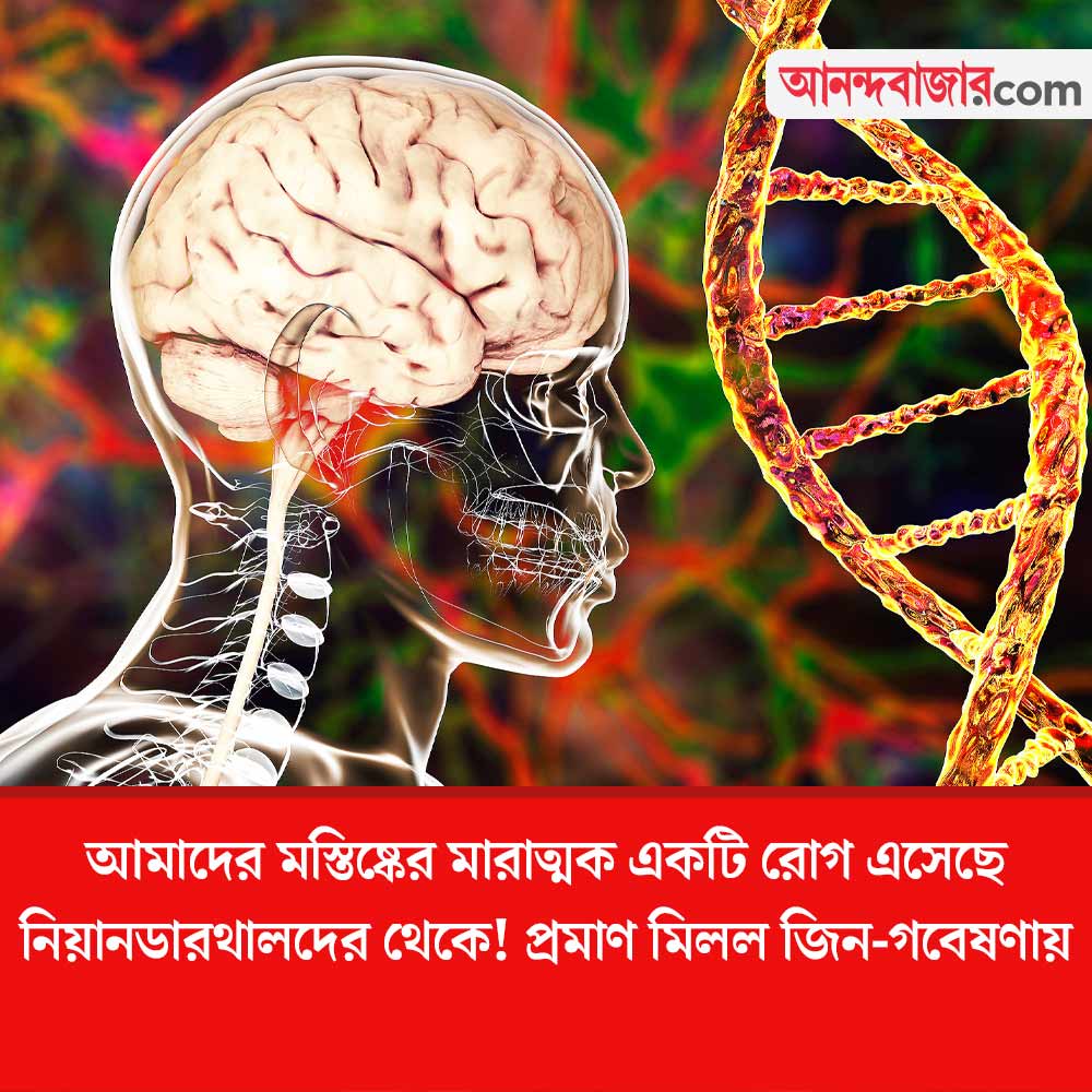 MyAnandaBazar's tweet photo. কোন রোগ? কত প্রাচীন তার উৎস?
#braindefects #Modernhumans #Neanderthalgenes #sciencenews
https://t.co/GBs4DjbYR0 https://t.co/WRdcuROqme