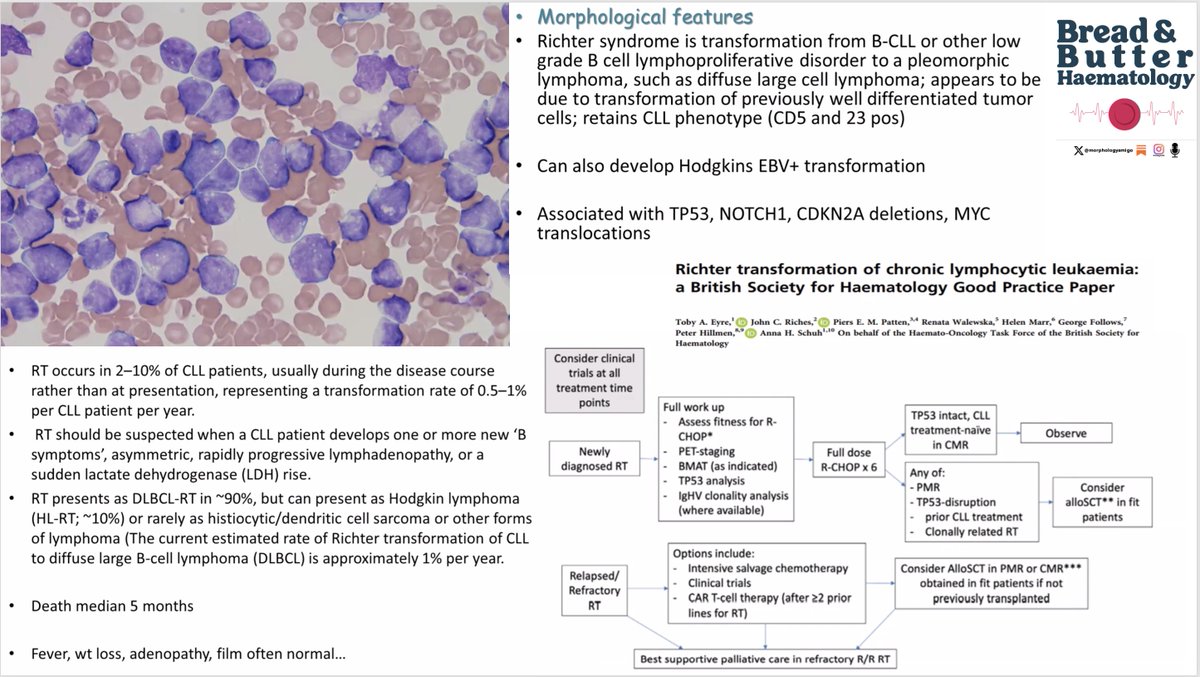 Richters Transformation 🔽🔽
Everything You need to Know in One Slide😀
From My SpR Teaching Series Set...
#medicine #hematology #medtwitter #blooducation