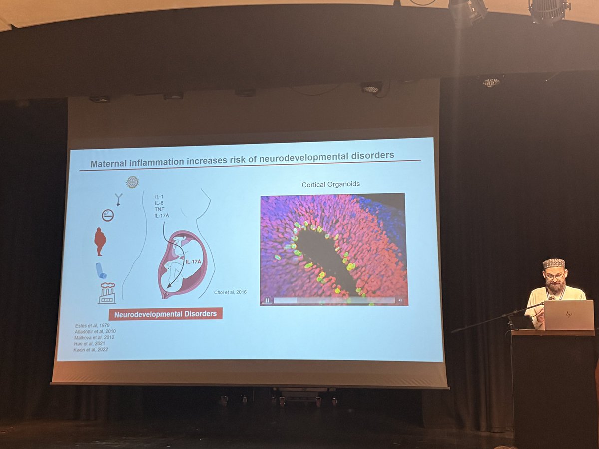 asmitanatomy99's tweet image. Fascinating talk 💡by Dr. Muhammad Assir (@drzamankhan) on how IL-17A disrupts cortical development in a 3D ex vivo MIA model—triggering early folding, increased thickness & neuronal maturation. 🧠📚 #AnatSocSummer25 #AnatSocOxford