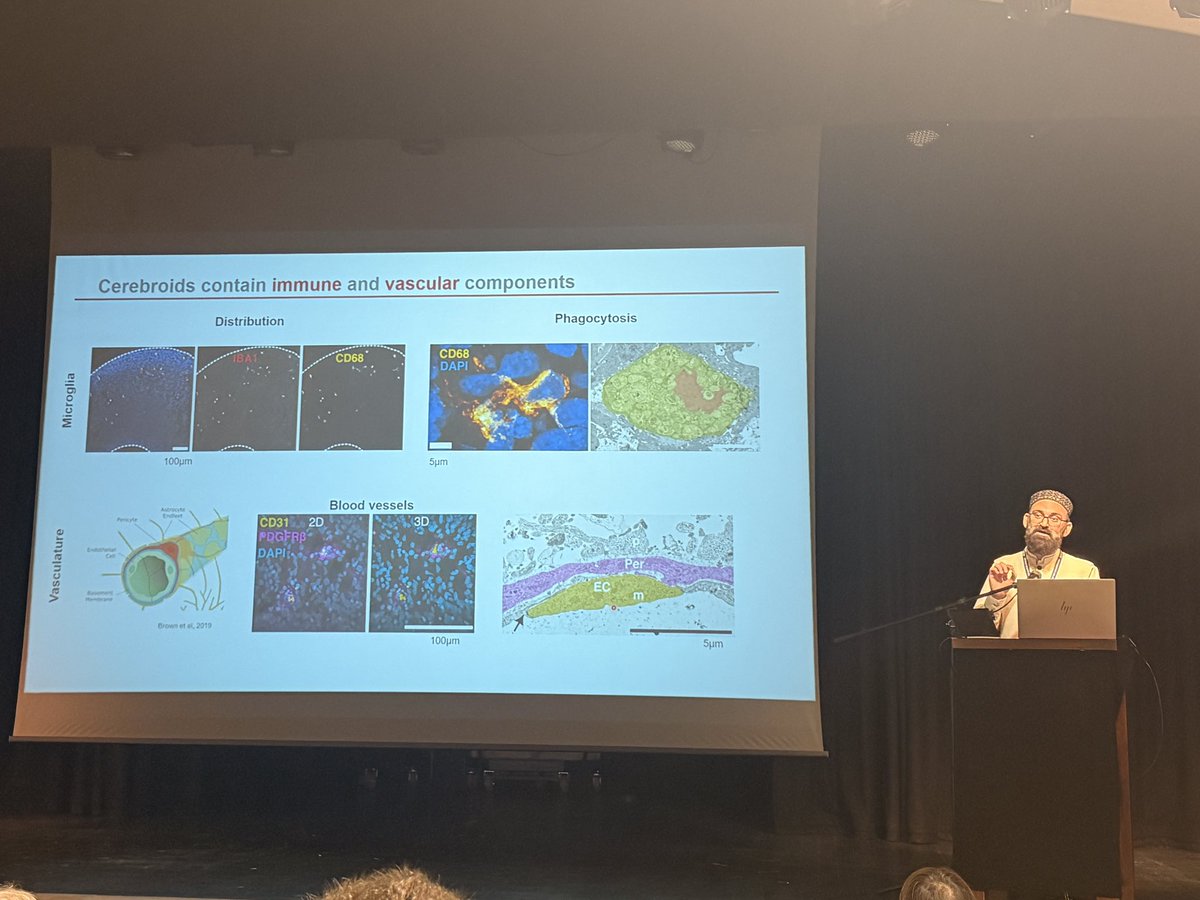asmitanatomy99's tweet image. Fascinating talk 💡by Dr. Muhammad Assir (@drzamankhan) on how IL-17A disrupts cortical development in a 3D ex vivo MIA model—triggering early folding, increased thickness & neuronal maturation. 🧠📚 #AnatSocSummer25 #AnatSocOxford