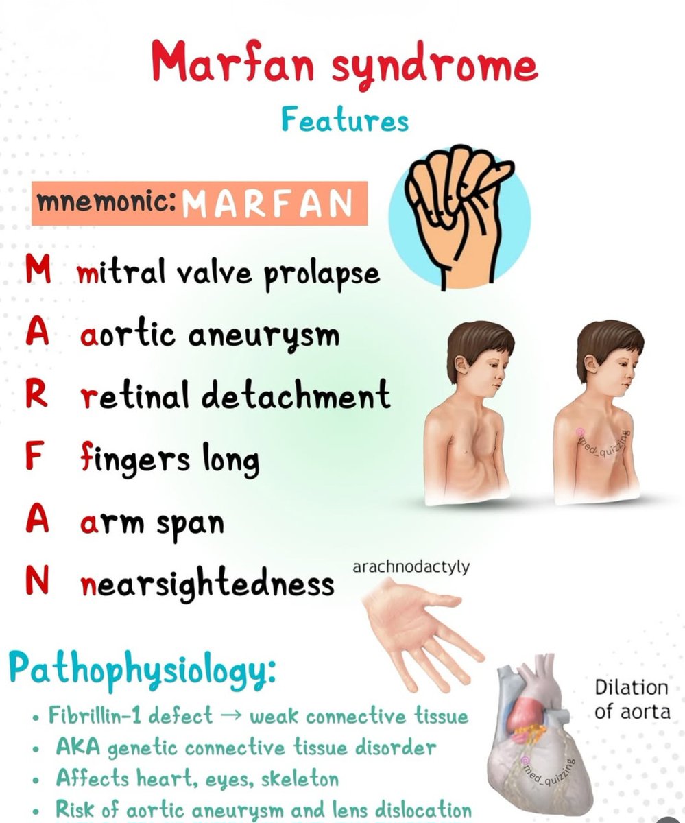 Remember MARFAN SYNDROME with easy mnemonic "MARFAN "