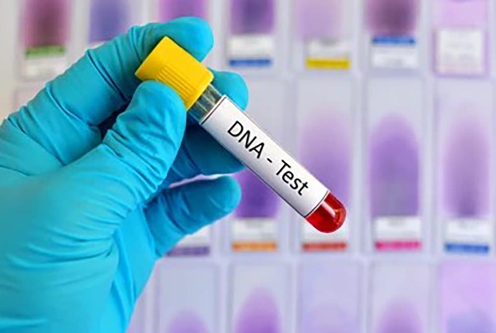 DNA test requests surge.
💉 94 cases in just 3 days at Wandegeya lab.
💉 95% by men, 3% by adult children.
💉 Shocking finding: 98% of tests return negative!
💉 Cost: UGX 1M per test.
💉 Should DNA testing be regulated in Uganda?