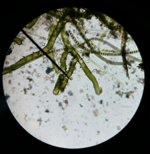 De niño veía unos "puntos" de vez en cuando en mis ojos, algo como lo de la imagen de la izquierda.

Coincidió con que me regalaron un microscopio y me puse a ver qué había en agua estancada, y se veían microbios como en la imagen de la derecha.

Entonces yo pensaba que con mis