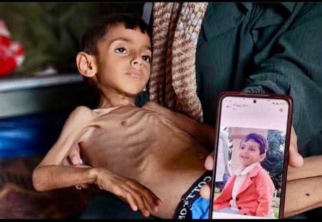 yemenstarvi's tweet image. Israel did this 🇵🇸💔