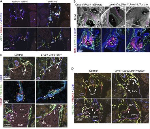 Waggoner Lab (@labwaggoner) on Twitter photo Lymphatic endothelial cell S1P/S1PR1 signaling plays a role in mesenteric TLS formation in the absence of subclinical inflammation and, importantly, is a key regulator of lymphatic valve development
rupress.org/jem/article/22…
<a href="/JExpMed/">Journal of Experimental Medicine</a>
rupress.org/jem/article/22… Lymphatic endothelial cell S1P/S1PR1 signaling plays a role in mesenteric TLS formation in the absence of subclinical inflammation and, importantly, is a key regulator of lymphatic valve development
rupress.org/jem/article/22…
<a href="/JExpMed/">Journal of Experimental Medicine</a>
rupress.org/jem/article/22…