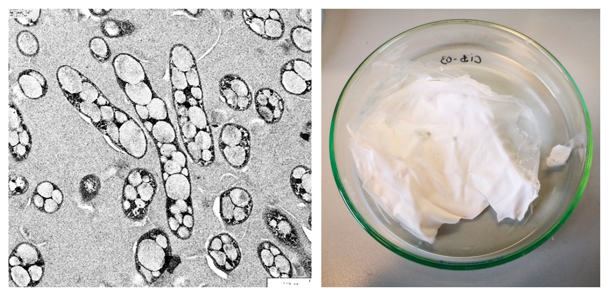 CIB Margarita Salas (CSIC) (@cib_csic) on Twitter photo #CIBpapers
The group led by Auxi Prieto at <a href="/CIB_CSIC/">CIB Margarita Salas (CSIC)</a> has made a significant advance in producing sustainable #bioplastics from food industry wastewater.
More information ➡️cib.csic.es/news/research/… #CIBpapers
The group led by Auxi Prieto at <a href="/CIB_CSIC/">CIB Margarita Salas (CSIC)</a> has made a significant advance in producing sustainable #bioplastics from food industry wastewater.
More information ➡️cib.csic.es/news/research/…