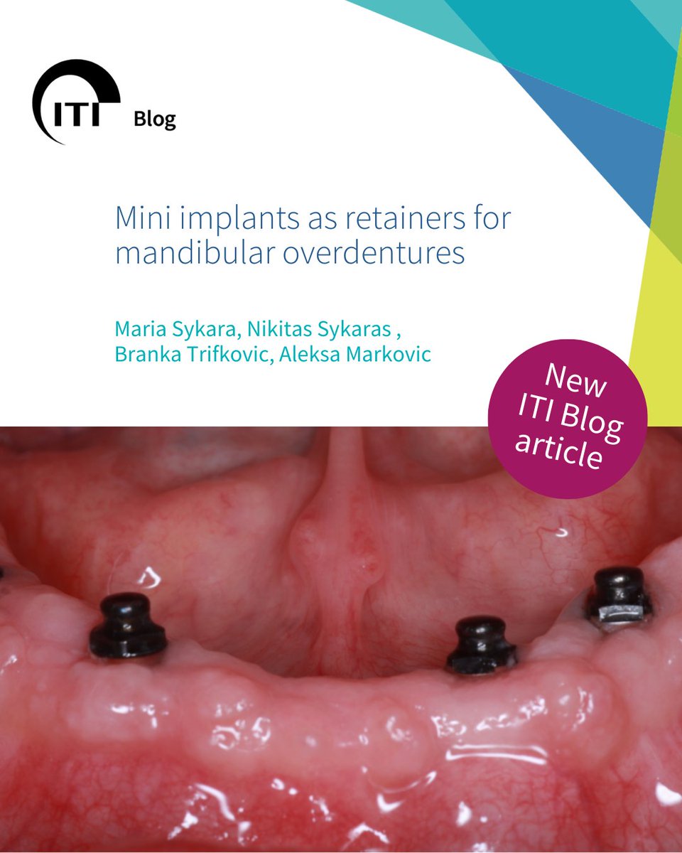 Explore the potential of mini dental implants as retainers for mandibular overdentures, including their advantages, patient outcomes, and clinical cases highlighting both surgical and prosthetic procedures, on the latest ITI Blog: bit.ly/4jE7nJL 
#iti #itiblog