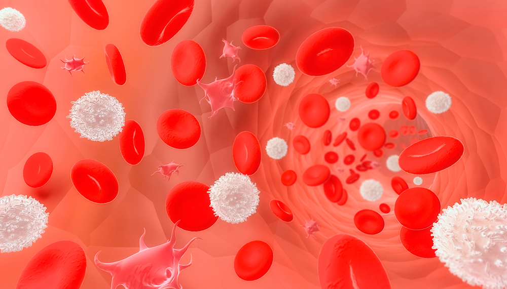 MPN_Hub's tweet image. New publication 📝 SANRECO phase I results presented by @MKremyanskaya at #EHA2025 show that divesiran reduced phlebotomy need and improved iron parameters in patients with PV.
Learn more: loom.ly/grC6lN8
#PolycythemiaVera #MedNews #MedEd #MPN #MPNsm
