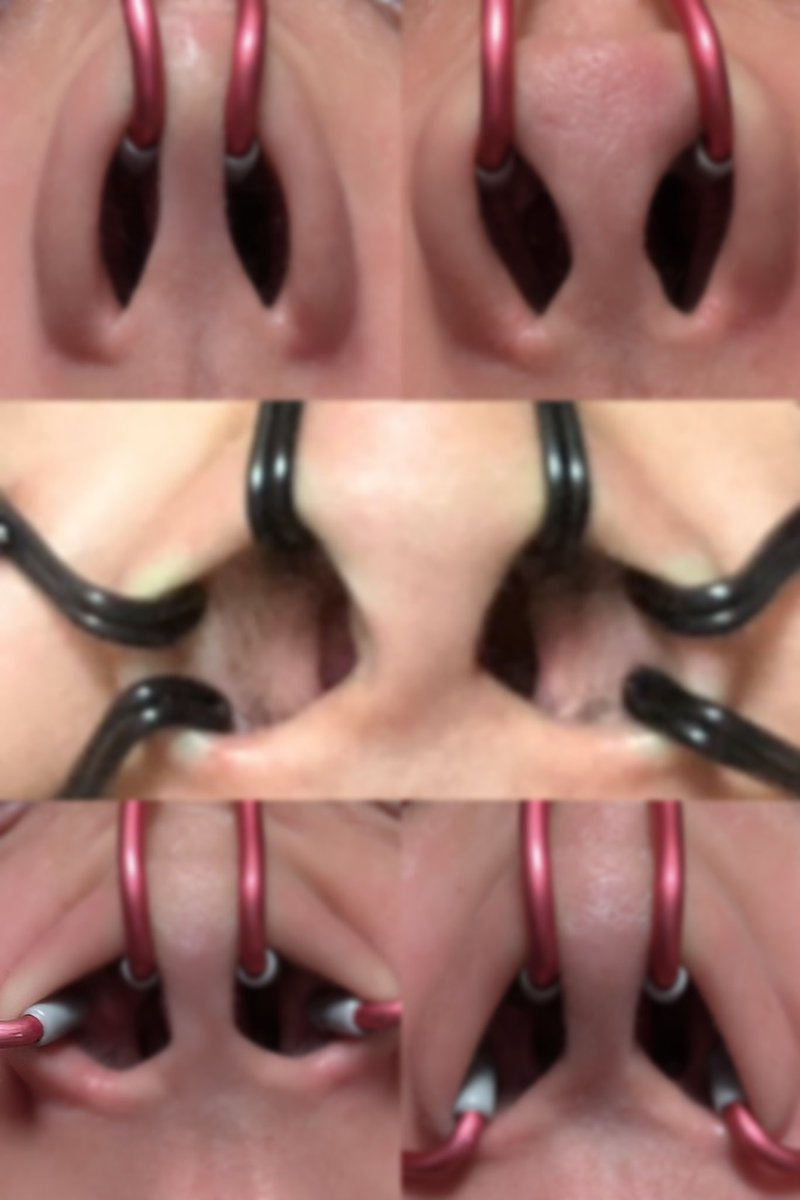 左上から

狭目、広目
5方向
3上目、3下目

ちょとモザイクかけた