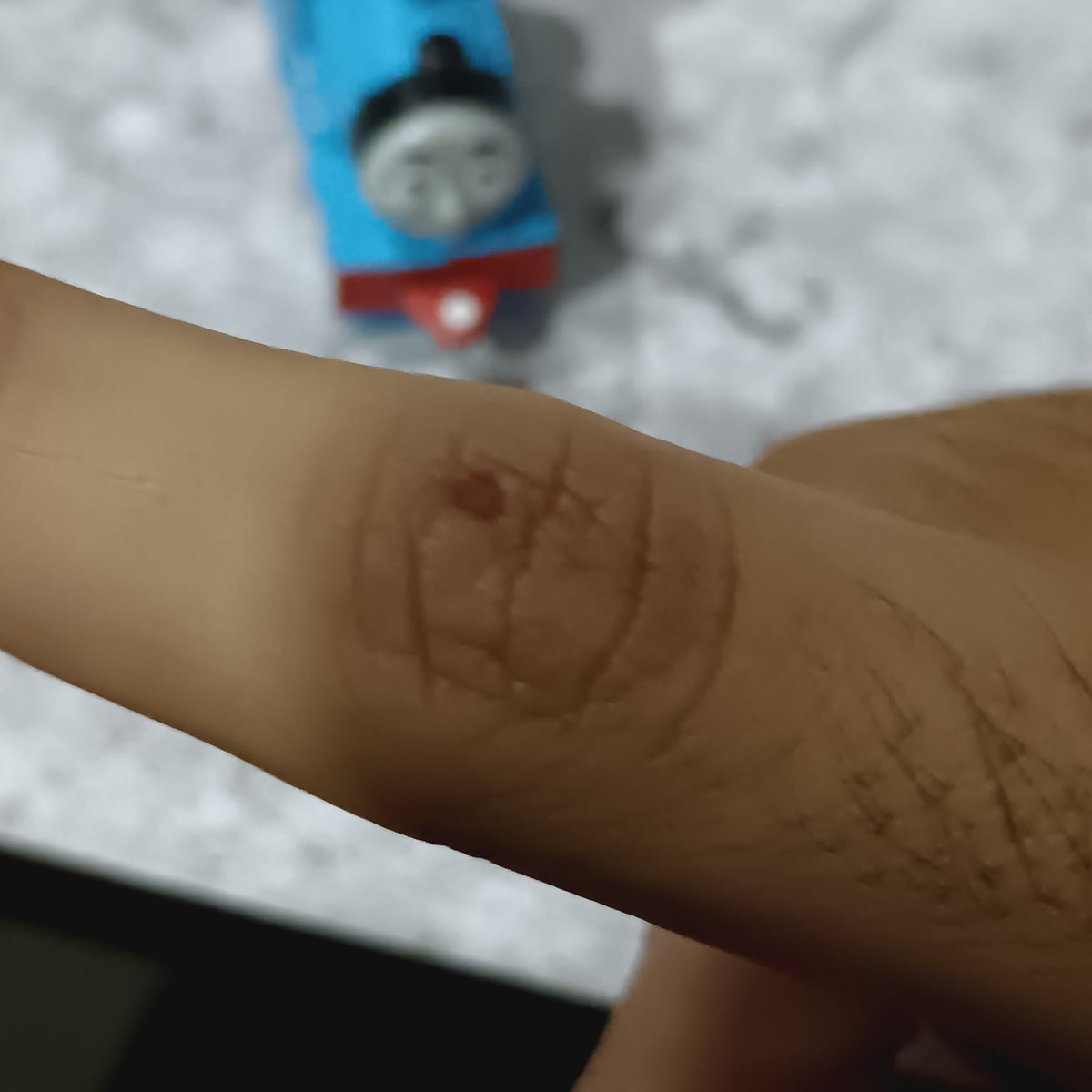kitoile's tweet image. i somehow got this cut on my finger from camp 2 days ago and it hurts so bad !! 😿😿