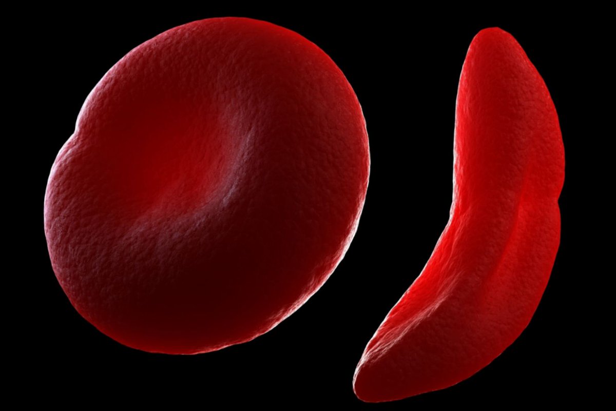 NationalMMPC's tweet image. Red blood cells live for about 120 days. Your kidneys help make the hormone (EPO) that keeps them coming!
#BloodFacts #Hematology #KidneyScience