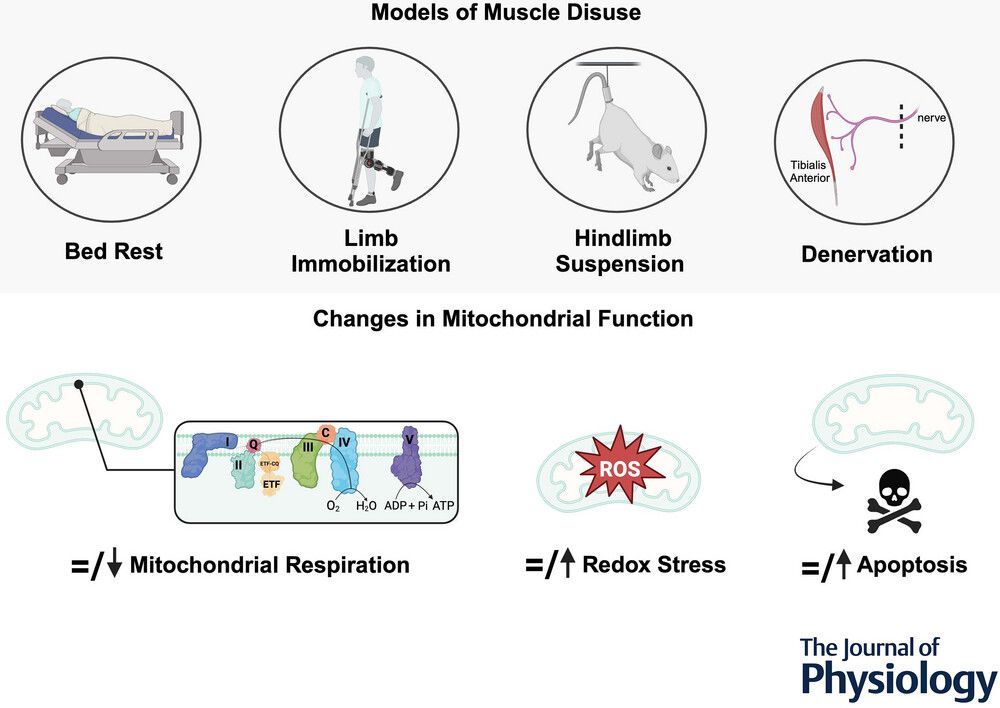JPhysiol's tweet image. Luca J. Delfinis (@YorkUKINE) et al. examine perspectives on the interpretation of #mitochondrial responses during skeletal muscle disuse-induced #atrophy in this #TopicalReview 🔬
📖 Read it here: buff.ly/zsEvO5K