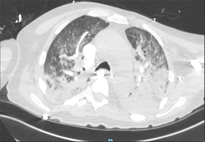 PulmPEEPs's tweet image. Check out the video of our UVA Case Files! Available on YouTube and VuMedi!
youtu.be/_Wf4PGH7Hmo