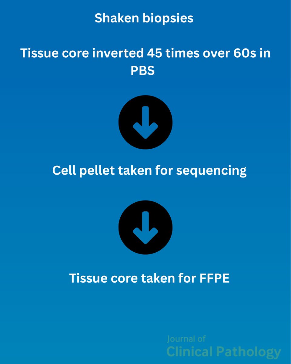 JClinPath_BMJ's tweet image. Ever heard of &apos;Shaken biopsies&apos; ? 🤔 
Read about this novel way to obtain material for genomics ! Open access too 🎉 
bit.ly/3S6zw0i