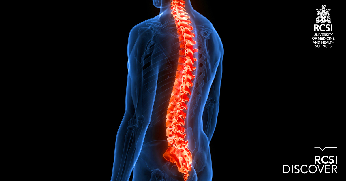 RCSI_Irl's tweet image. An implant developed by RCSI and @ambercentre researchers has been shown to deliver electrical stimulation to injured areas of the spinal cord.
The study, in partnership with @IRFUCharTrust, offers a potential route for nerve repair.
➡️ rcsi.com/dublin/news-an…
#RCSIdiscover