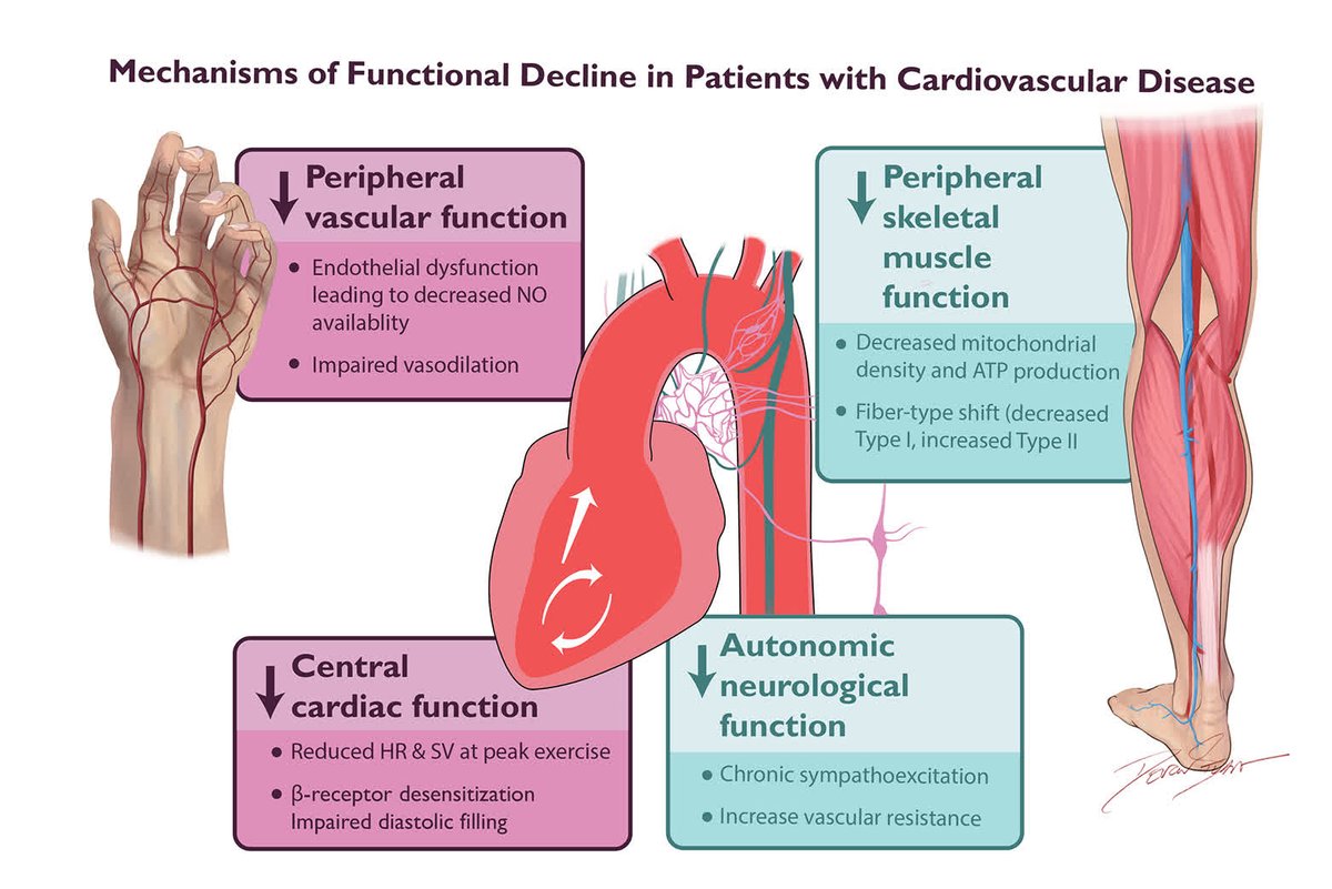 Circulation Research (@circres) on Twitter photo <a href="/CircRes/">Circulation Research</a> Compendium on #Cardiopulmonary Disease and #Exercise
Benefits of #Cardiac Rehabilitation: Mechanisms to Restore Function and Clinical Impact ahajrnls.org/3IuLlvE
Authored by <a href="/DrDamluji/">Abdulla A. Damluji, MD, PhD</a> & colleagues
<a href="/ParagGoyalMD/">Parag Goyal MD MSc</a> <a href="/S_FoulkesAEP/">Steve Foulkes</a> <a href="/CircRes/">Circulation Research</a> Compendium on #Cardiopulmonary Disease and #Exercise
Benefits of #Cardiac Rehabilitation: Mechanisms to Restore Function and Clinical Impact ahajrnls.org/3IuLlvE
Authored by <a href="/DrDamluji/">Abdulla A. Damluji, MD, PhD</a> & colleagues
<a href="/ParagGoyalMD/">Parag Goyal MD MSc</a> <a href="/S_FoulkesAEP/">Steve Foulkes</a>