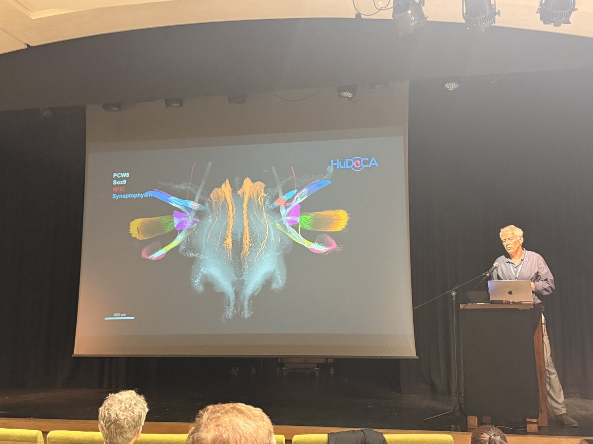 asmitanatomy99's tweet photo. Really insightful findings 💡 from Prof. Alain Chédotal (@AlainChedotal) on “Tridimensional analysis of human nervous system development”- especially using segmentation to visualise Circle of Willis formation from embryo to adult 🧠🧬. #AnatSocSummer25 #AnatSocOxford https://t.co/4spLKyTPRk