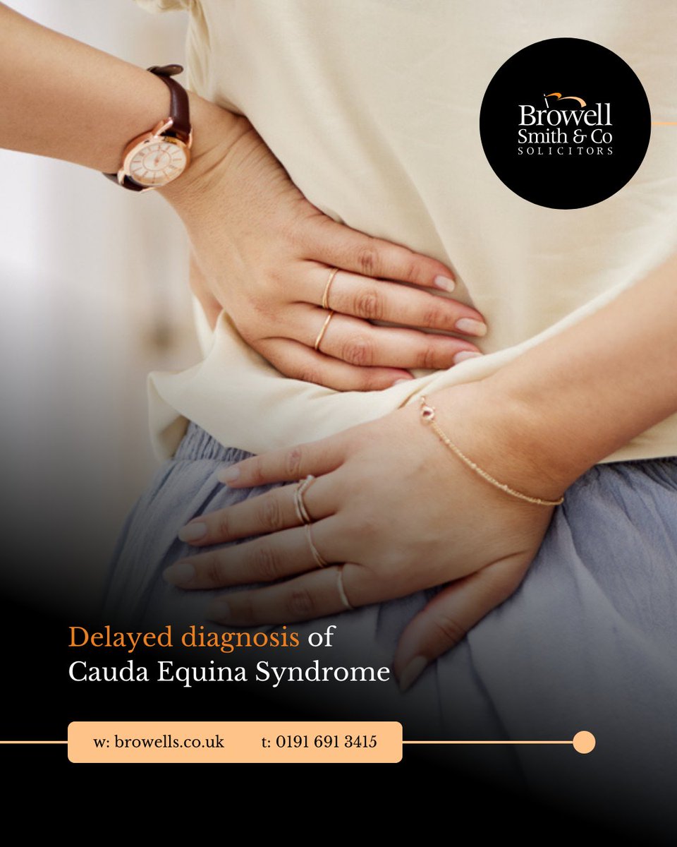 Delayed diagnosis of Cauda Equina Syndrome can lead to life-changing consequences.
If you've suffered due to medical negligence, you may have grounds for a claim.

We help clients affected by Cauda Equina Syndrome access the compensation they deserve: bit.ly/2Vg7UbJ
