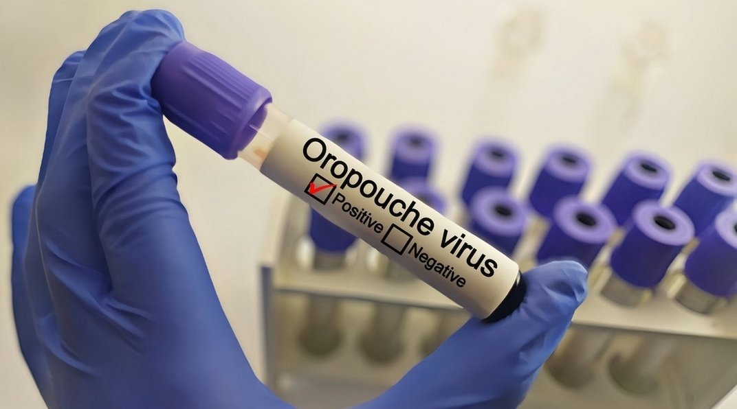 Clinical focus: Oropouche virus (OROV)

An emerging arbovirus causing acute febrile illness in Latin America and the Caribbean. Increasingly relevant in travel and tropical medicine.

#IDTwitter #TravelMed #Virology