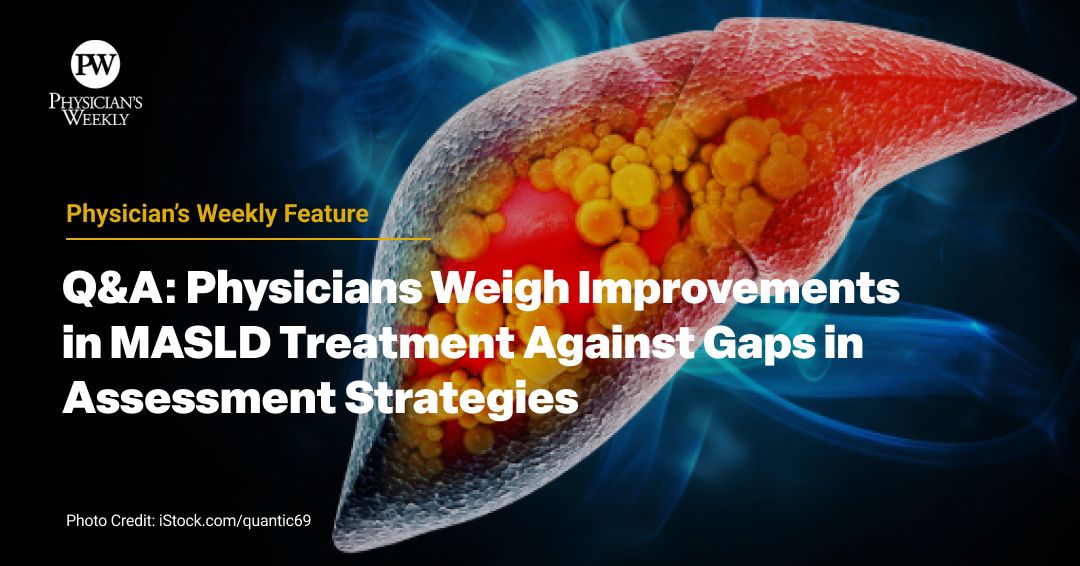 Physician's Weekly (@physicianswkly) on Twitter photo MASLD (Metabolic dysfunction-associated steatotic liver disease) cases are rising  and new treatments are emerging. But experts stress the critical need for improved diagnostic & monitoring tools to guide effective patient care. buff.ly/J3d9yWk 
 #LiverHealth #Obesity MASLD (Metabolic dysfunction-associated steatotic liver disease) cases are rising  and new treatments are emerging. But experts stress the critical need for improved diagnostic & monitoring tools to guide effective patient care. buff.ly/J3d9yWk 
 #LiverHealth #Obesity