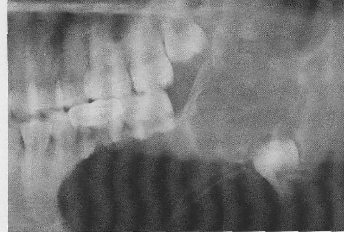 aboutDent's tweet photo. Differential diagnosis? https://t.co/xXrNIElMdO
