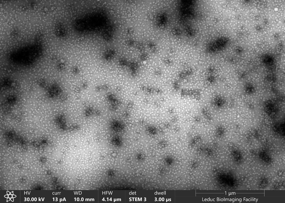 DjuranovicLab's tweet image. First RAPPL ribosome isolation at the new lab space at Brown University. Purification from a small culture of parasitic Eukaryote. Soon out...
biorxiv.org/content/10.110…