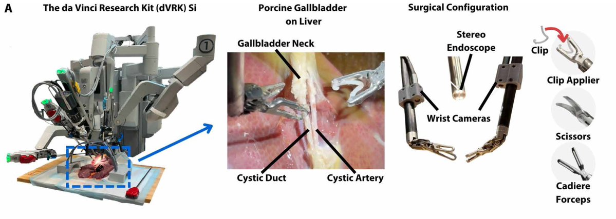 AI in medicine: what happened this week? 🧵

1. A robot that does surgery with no human help

Trained by watching human surgeons, it did 17 steps in gallbladder removal, using gallbladders taken from pigs (ex vivo) – and self-corrects if it makes a mistake 

This is some way from