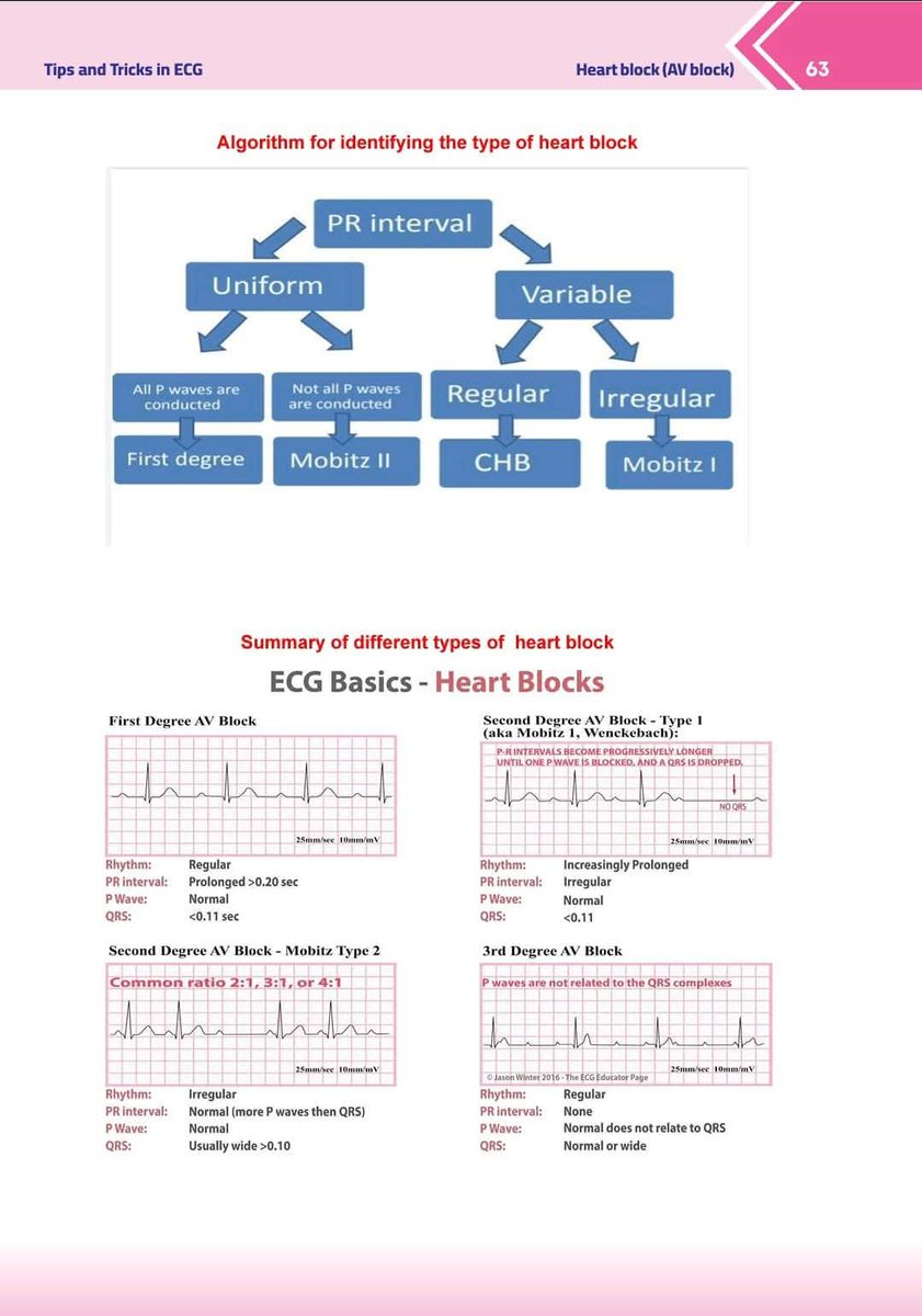 📖 Struggle with ECGs?
This page from “Tips and Tricks in ECG” makes heart blocks 🫀 easy with clear flowcharts &amp; real strips!

🎯 Perfect for med students &amp; residents.

💬 Reply “Tips” if you want the full book!
#ECG #MedEd #Cardiology #FOAMed #HeartBlock