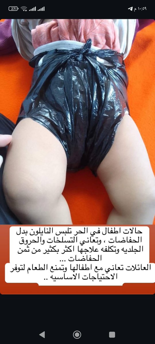 balmassri8's tweet image. I still can't afford a $100 diaper bag for my little ones. He has sensitive skin due to using nylon instead of diapers. Look at him. This is part of the daily struggle. Please help me.
gofund.me/f4e6996d
@ireallyhateyou @DrNeenaJha @yung_coxey @sasa_ghada @Suzesuesuzie…