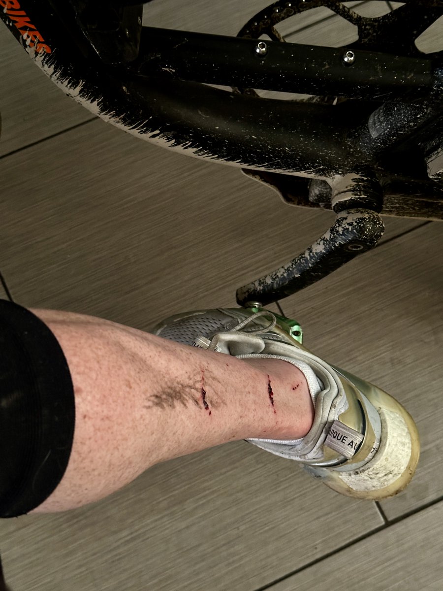 JohnnyRayBee's tweet image. Bloody, muddy, fun ride today ...