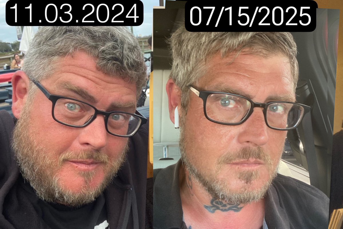 jamiedlux's tweet image. 8 months sober, today.  (Other pic was from 2 weeks before i quit drinking).