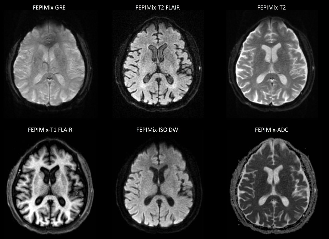 Thread ✍🏻

MRI Sequence The purpose of using each Sequence.