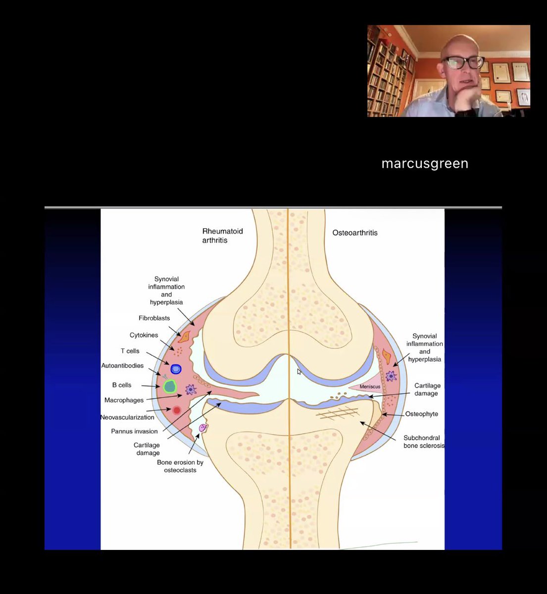 MidlandOrth's tweet photo. ✅ And that’s a wrap to conclude our busy spring/summer 2025 education series
A great zoom tonight with Mr Green who gave an interesting talk:
“Injections into joints - common practice but what, why and when” 
For further details email: 
Michelle@midlandorthopaedicpractice.co.uk https://t.co/pFJ8U0H3sE