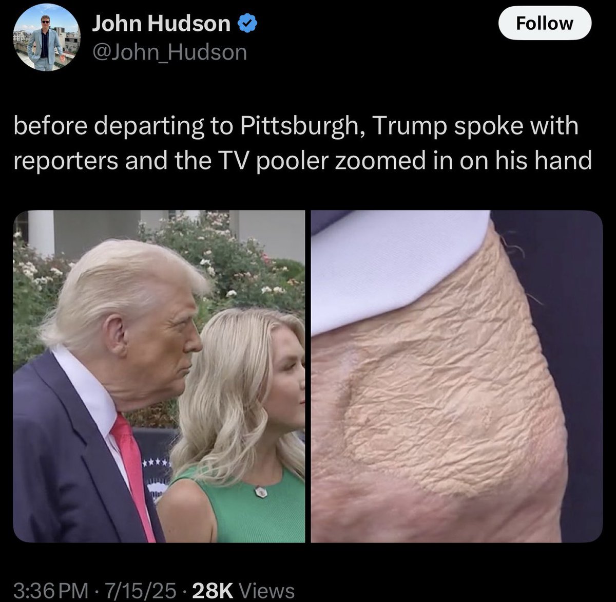 Ron Filipkowski (@ronfilipkowski) on Twitter photo Who will be the first to ask him about this ongoing issue with his hand? Who will be the first to ask him about this ongoing issue with his hand?