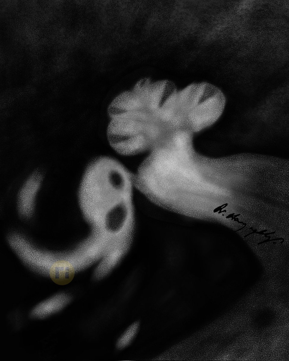 drharunyildiz's tweet image. Endolymphatic Hydrops
doi.org/10.1007/s00234…
#radiologicalillustration ✍️
pixel by pixel handmade!